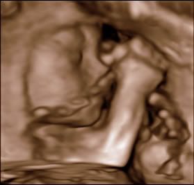 Ultrasound 5-6-2011